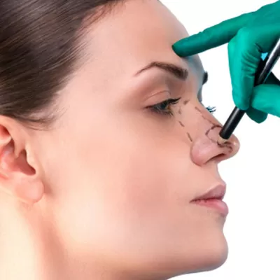 Rinoplastia